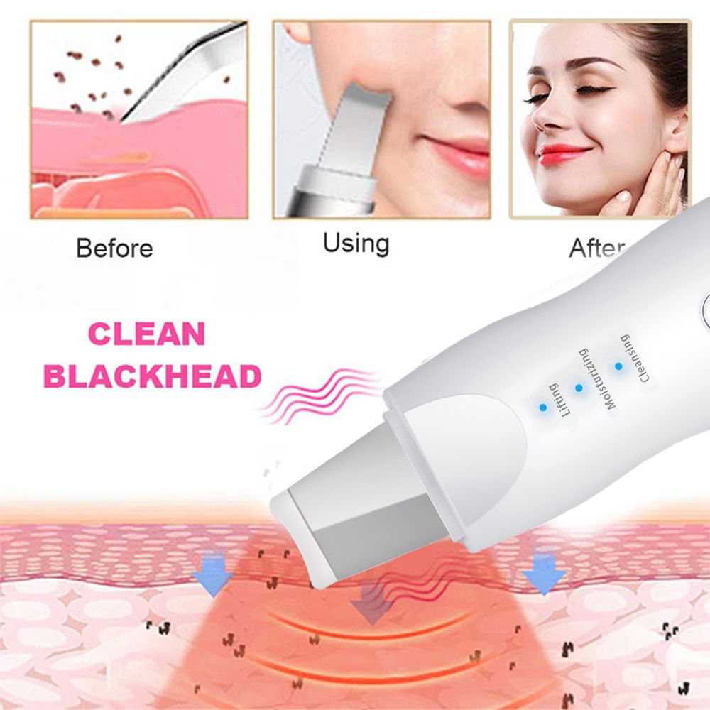 Blackhead Remover Vacuum Skin Scrubber Facial Cleansing Peeling Machine Pore Cleaner Facial Steamer Acne Remover Skin Care Tool