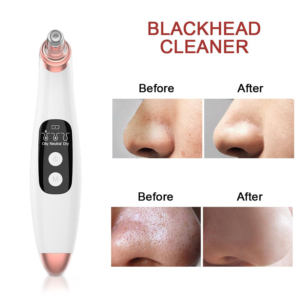 Electric Acne Blackhead Remover Point Noir Vacuum Extractor Tool Nano Facial Sprayer Steamer Humidifier Black Spots Pore Cleaner