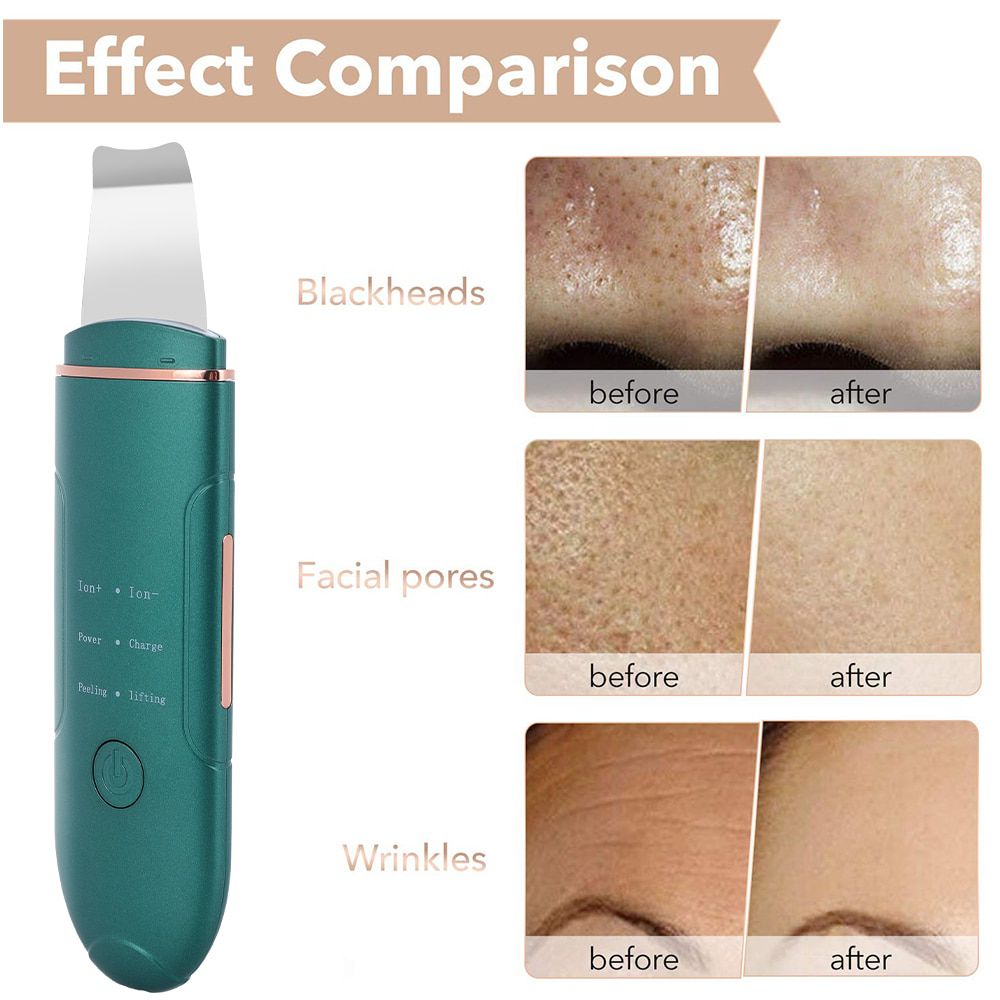 New Ultrasonic Skin Scrubber Deep Face Cleaning Machine Peeling Shovel Facial Pore Cleaner Face Skin Scrubber Lift Machine