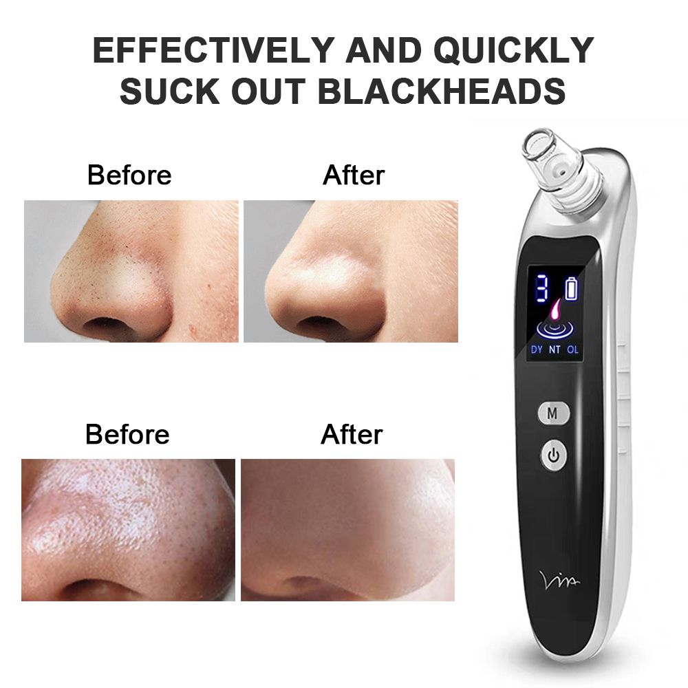 Electric Blackhead Remover 