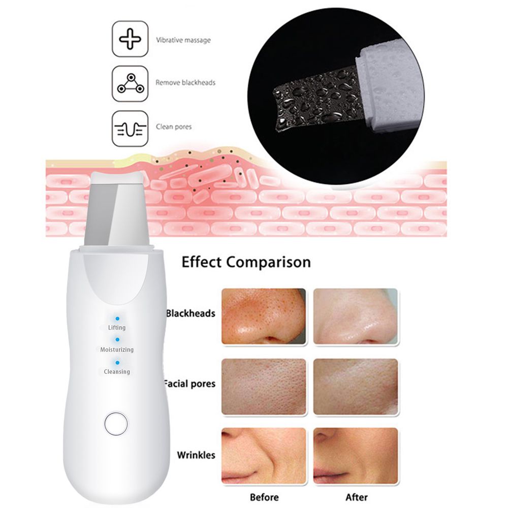 Electric Blackhead Remover 