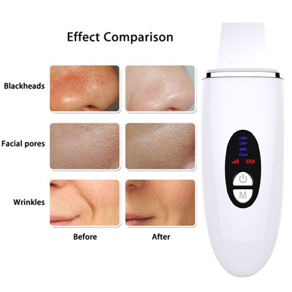 Ultrasonic Blackhead Remover 