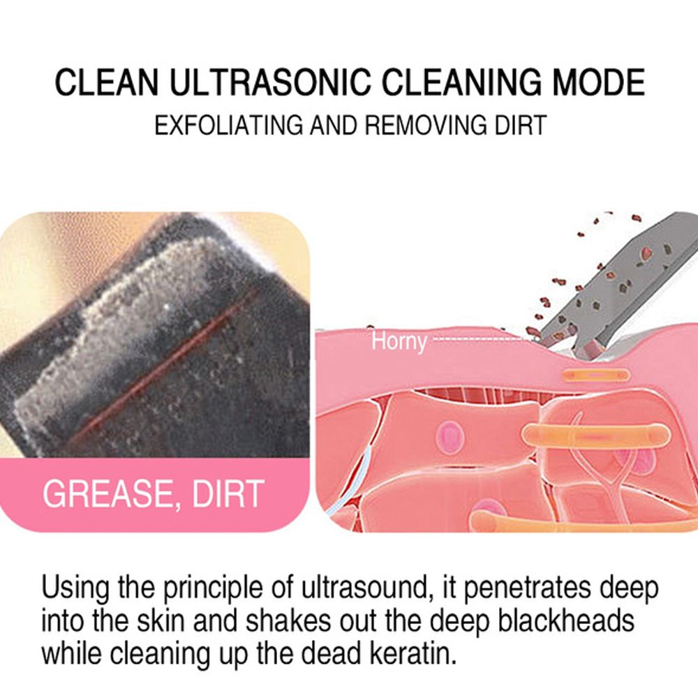 Ultrasonic Blackhead Remover 