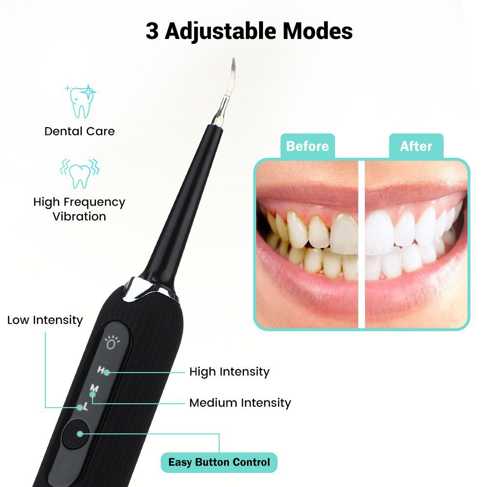 Portable Electric Sonic Dental Scaler Tooth Calculus Remover Tooth Stains Tartar Tool Dentist Teeth Whitening Toothbrush USB