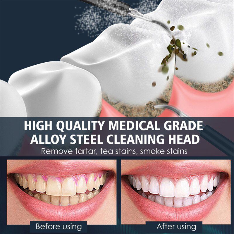 Electric Toothbrush Ultrasonic Teeth Cleaner 